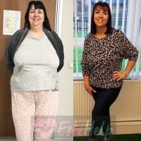 Estehelp Gastric Sleeve Surgery in Turkey - Price/Cost & Reviews 1