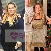 Estehelp Gastric Sleeve Surgery in Turkey - Price/Cost & Reviews 3