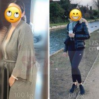Estehelp Gastric Sleeve Surgery in Turkey - Price/Cost & Reviews 4