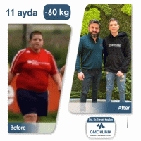 Dr.Necat Kaplan Gastric Sleeve Surgery in Turkey - Price/Cost & Reviews 6